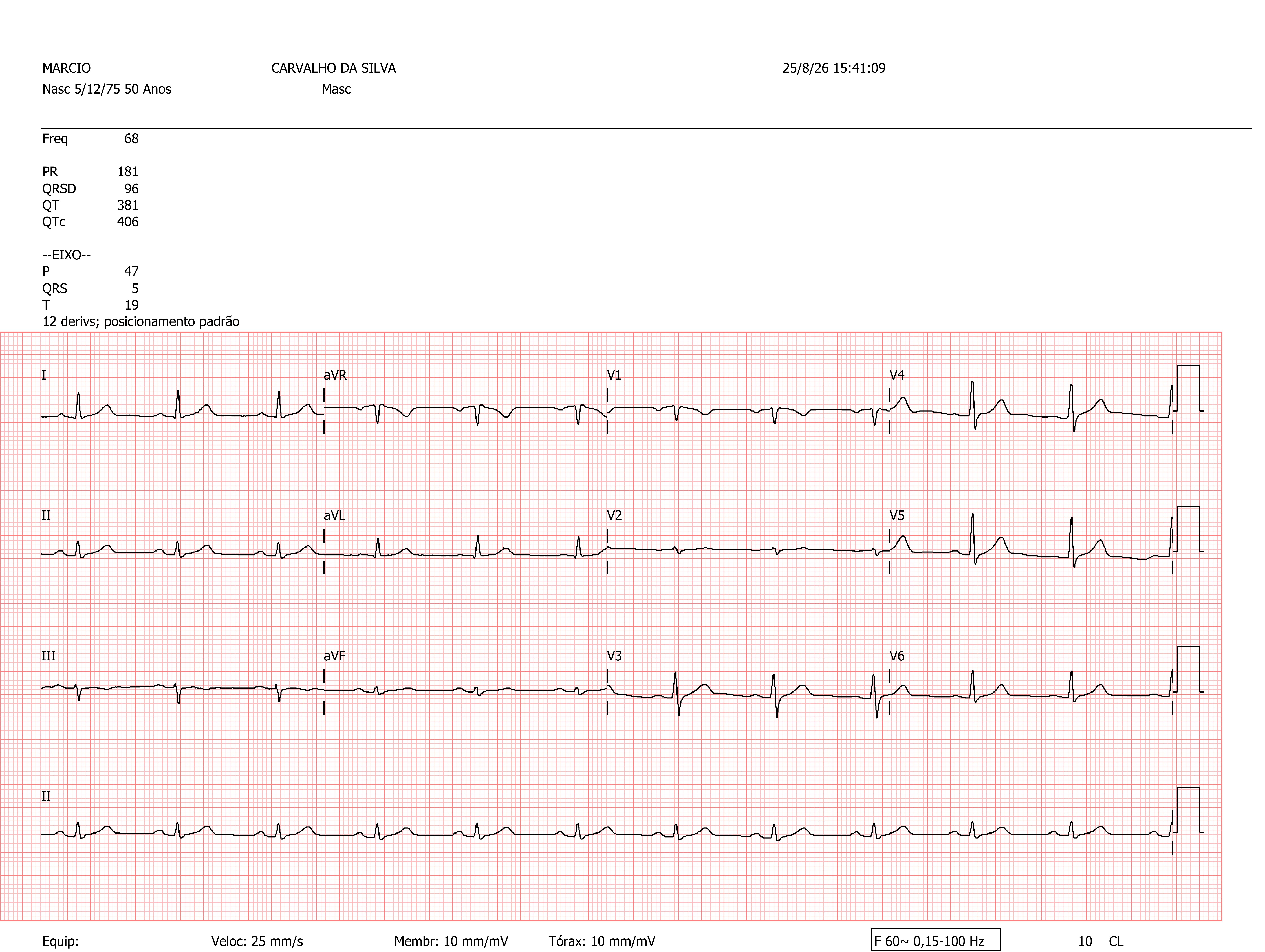 Pagina 2 de 2 do laudo Eletrocardiograma de repouso