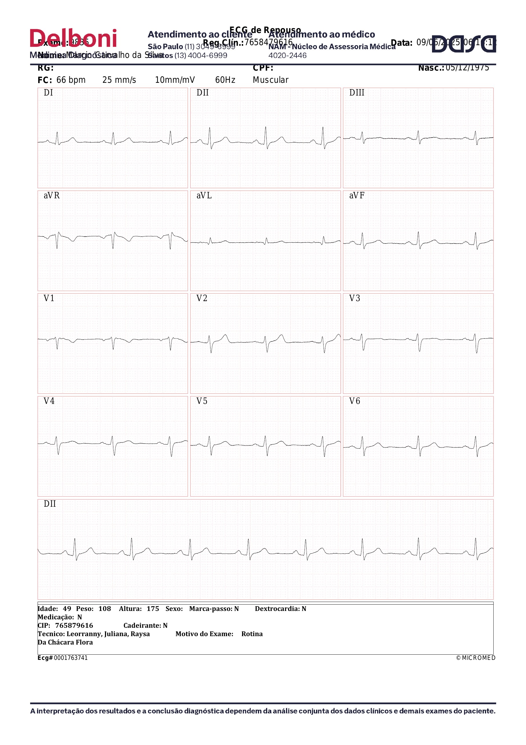 Pagina 2 de 2 do laudo Eletrocardiograma de repouso